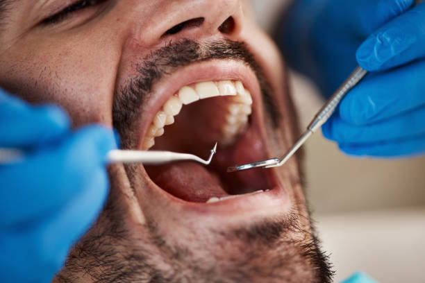 Best Emergency Dental Care for Abscessed Tooth in Cockeysville, MD